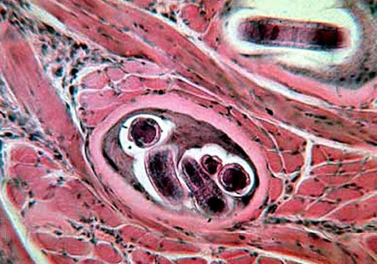 Dvejus metus neužregistruota žmonių trichineliozės atvejų