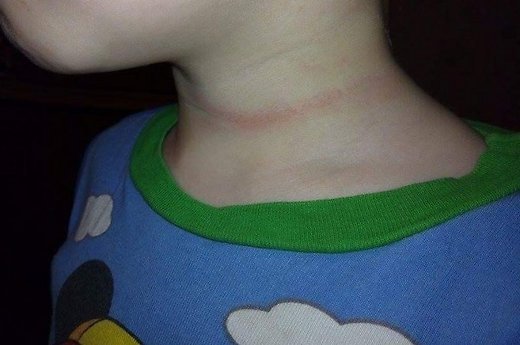 Prabilo ir kiti tėvai: smaugimas šokdyne – nieko tokio? (4)