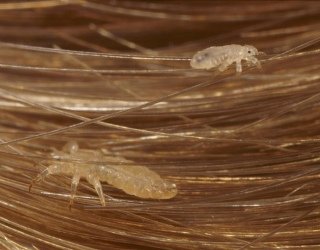 Prieš grįžtant į mokyklą – patikra dėl utėlių