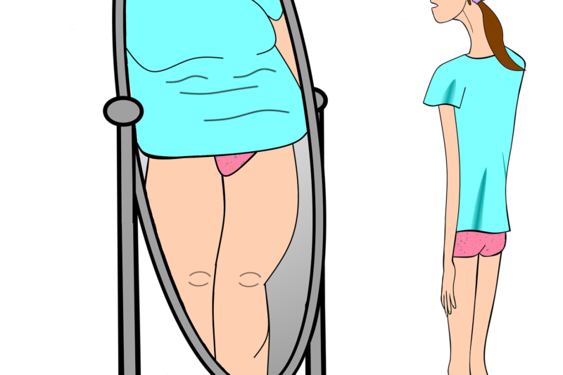 Psichologė pataria tėvams, kaip reaguoti ir ko imtis, jei jų vaikas save alina dietomis