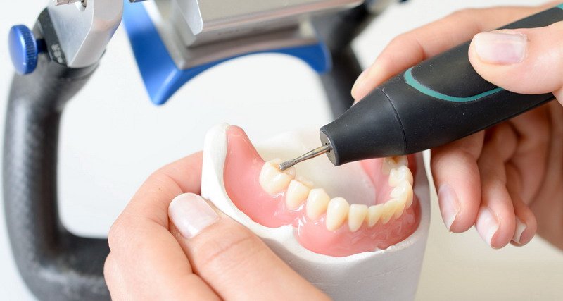 Skandalas: pacientų burnose atsidūrė 1000 nelegalių dantų protezų (15)