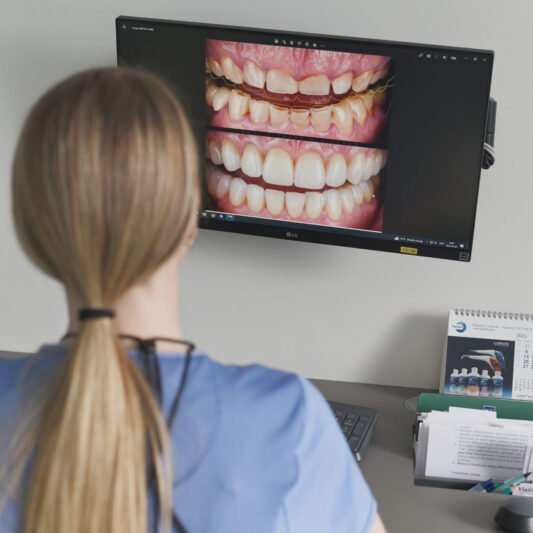 Ar žinojote, kokių privalumų suteikia dantų protezavimas? (3)