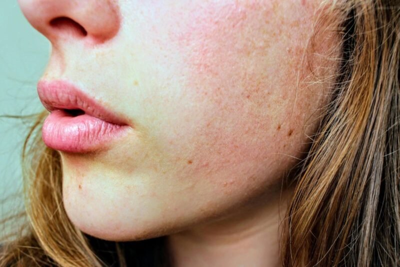 Dermatoskopija: kaip šis tyrimas padeda aptikti odos pokyčius?